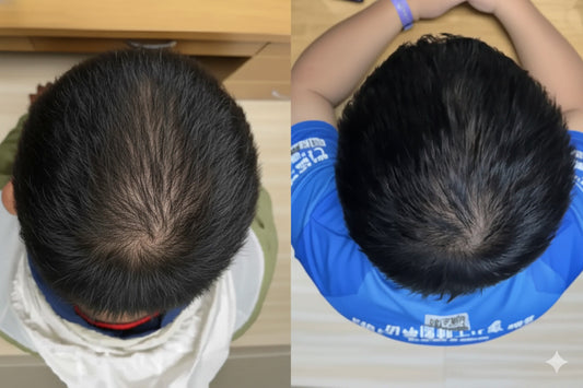 Cica Hair Growth Serum: Clinical Proof in Just 56 Days